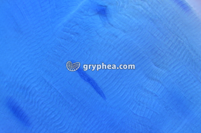 Noyau cellule musculaire x400 - gryphea.com